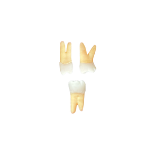 KIT dentes Endo Positivo - Londrina (10401)