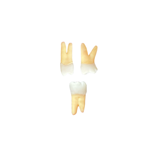 KIT dentes Endo Positivo - Londrina (10401)