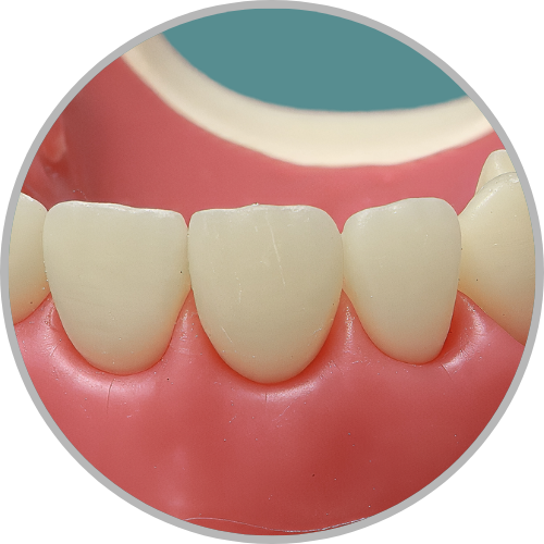 Dente 11 - Hígido (cod:11.0)