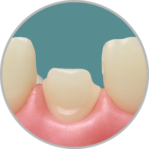 Dente 11 - Anatomia dental / Morfologia (cod:11.S)