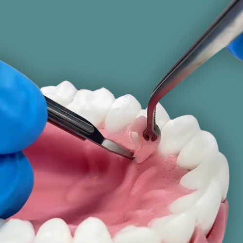 Linha de Manequins de especialização Orais com gengiva em duas camadas e osso para osteotomia