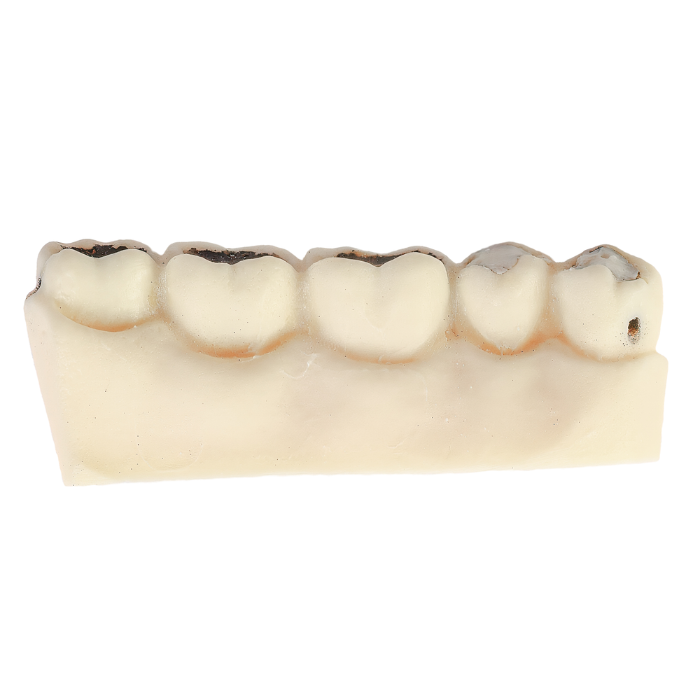 MACRO SIMULADOR DE CARIE- CONAISSANCE (11000)