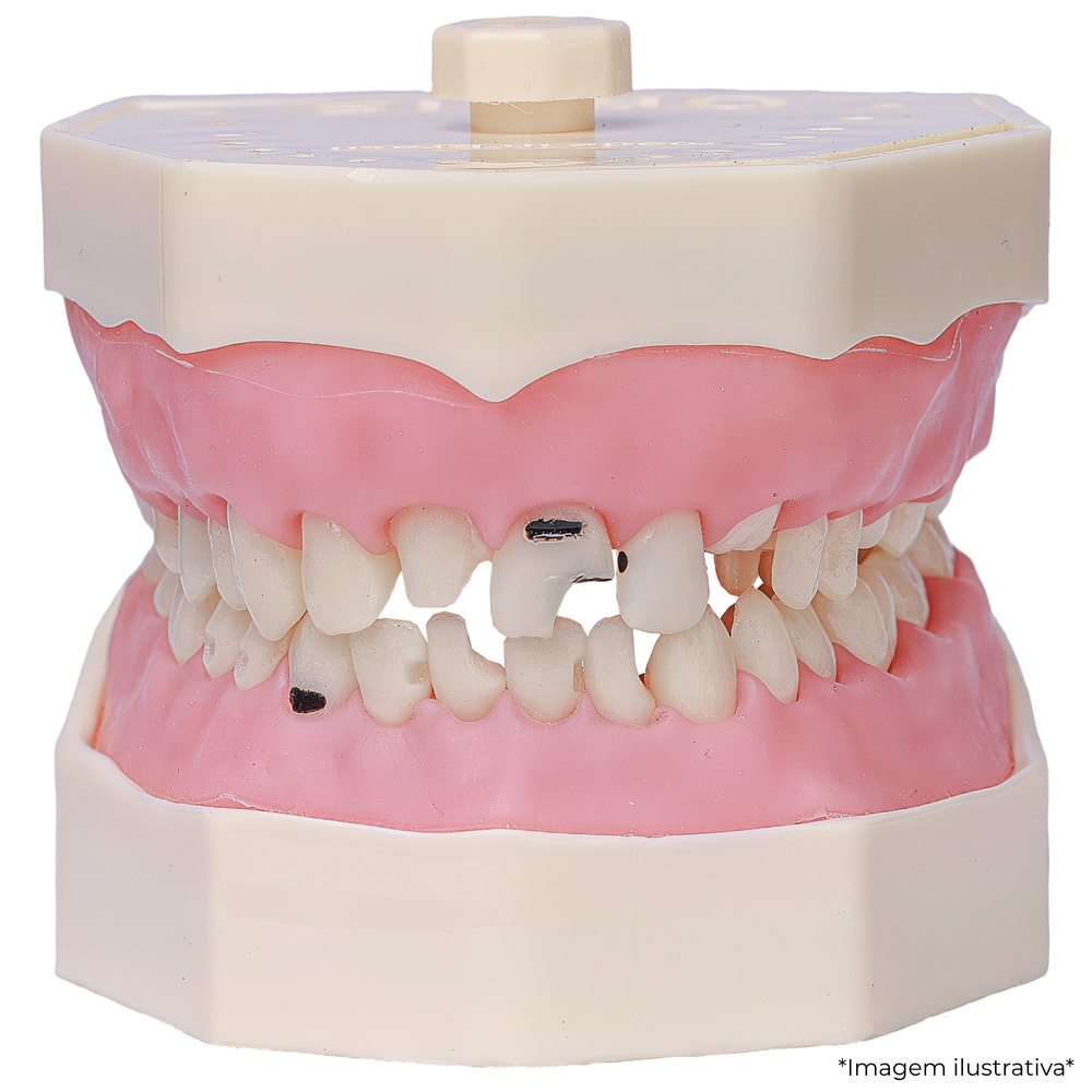 MNQ MATERIAIS DENTARIOS UNIVINTE (537)