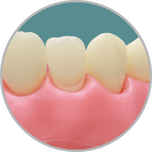 Dente 12 - Classe V (V) (cod:12.H)