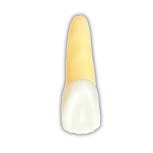 DENTE ENDO 21 RADIOPACO
