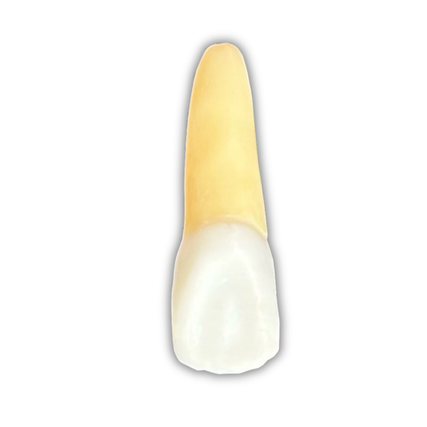 DENTE ENDO 21 RADIOPACO