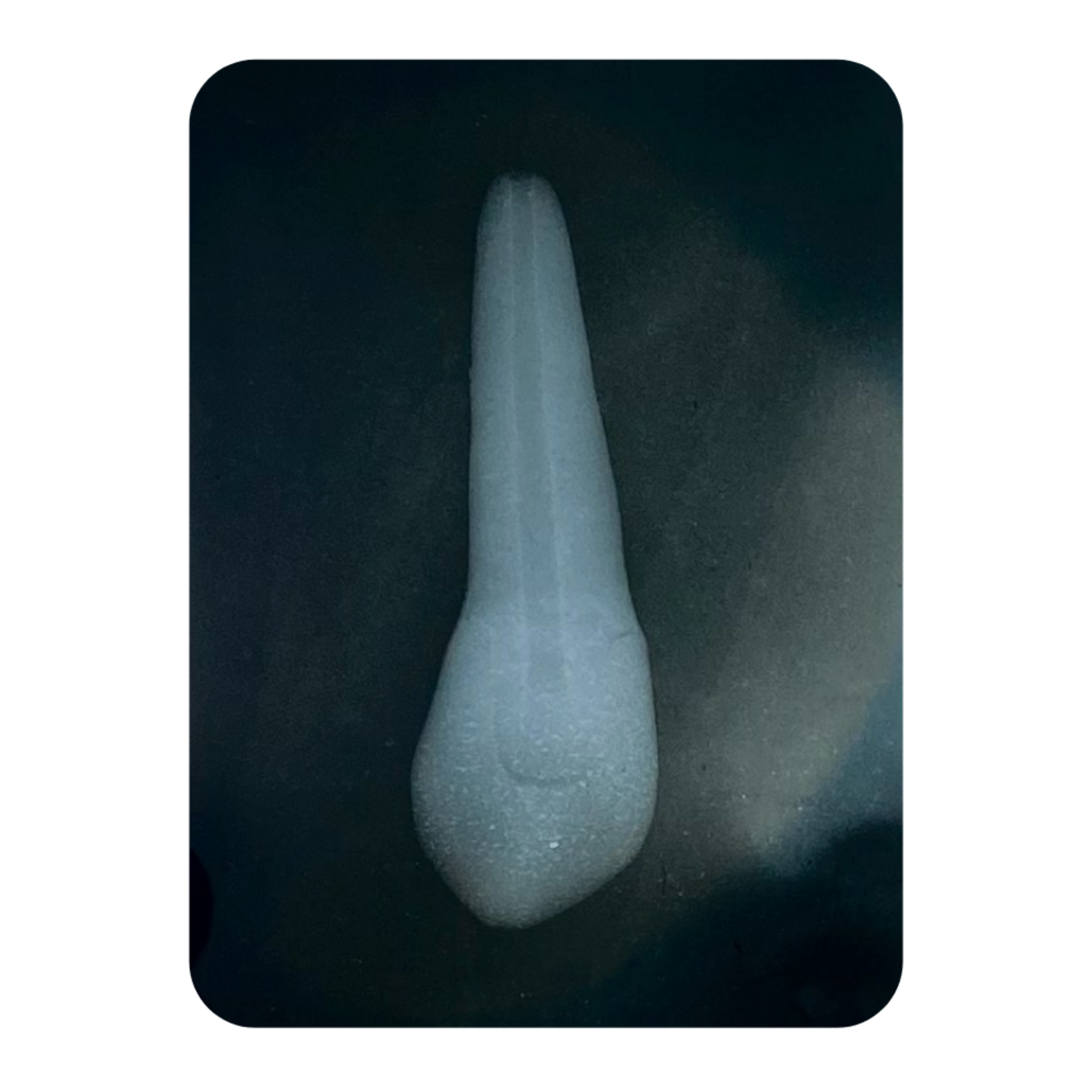 Radiografia periapical do Dente Orais 1423 — contraste radiopaco semelhante à dentina natural