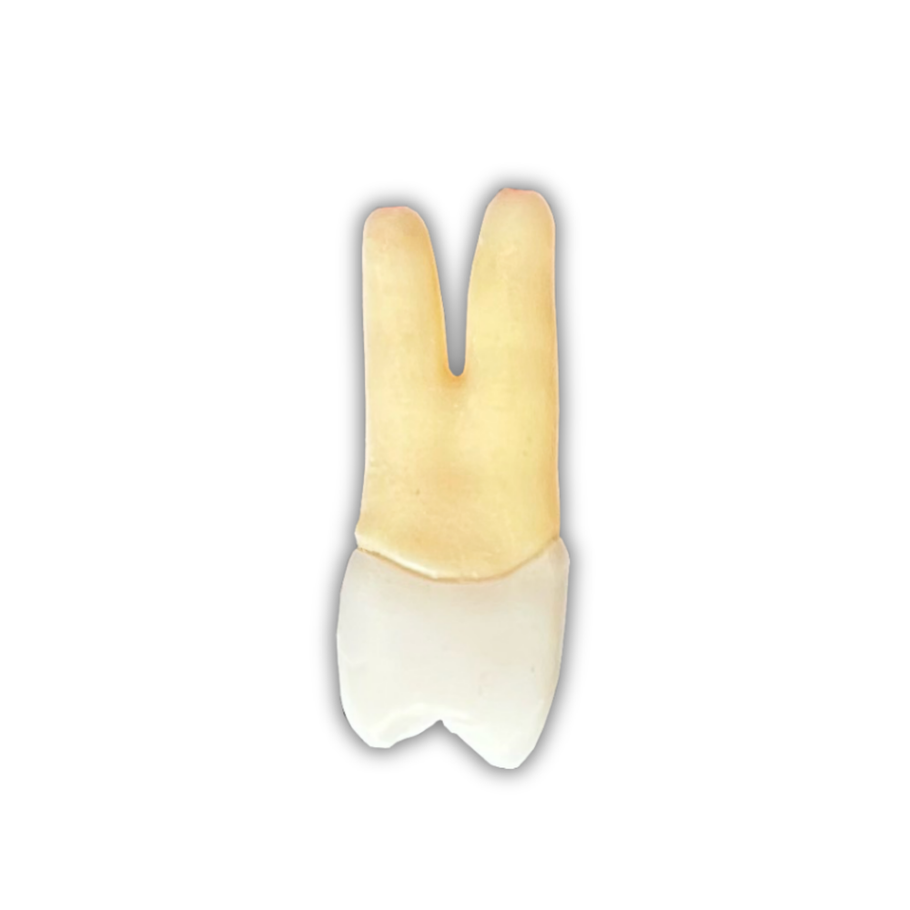 DENTE ENDO 24 RADIOPACO