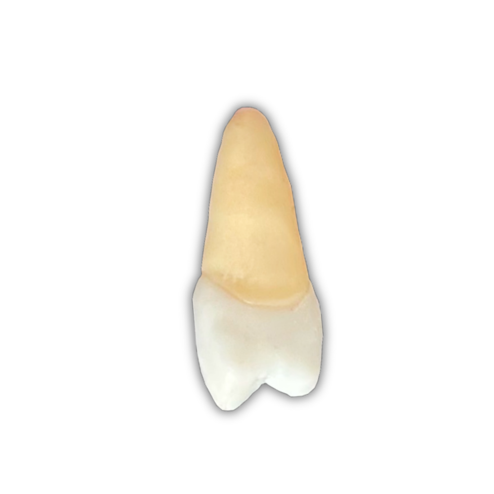 DENTE ENDO 25 RADIOPACO