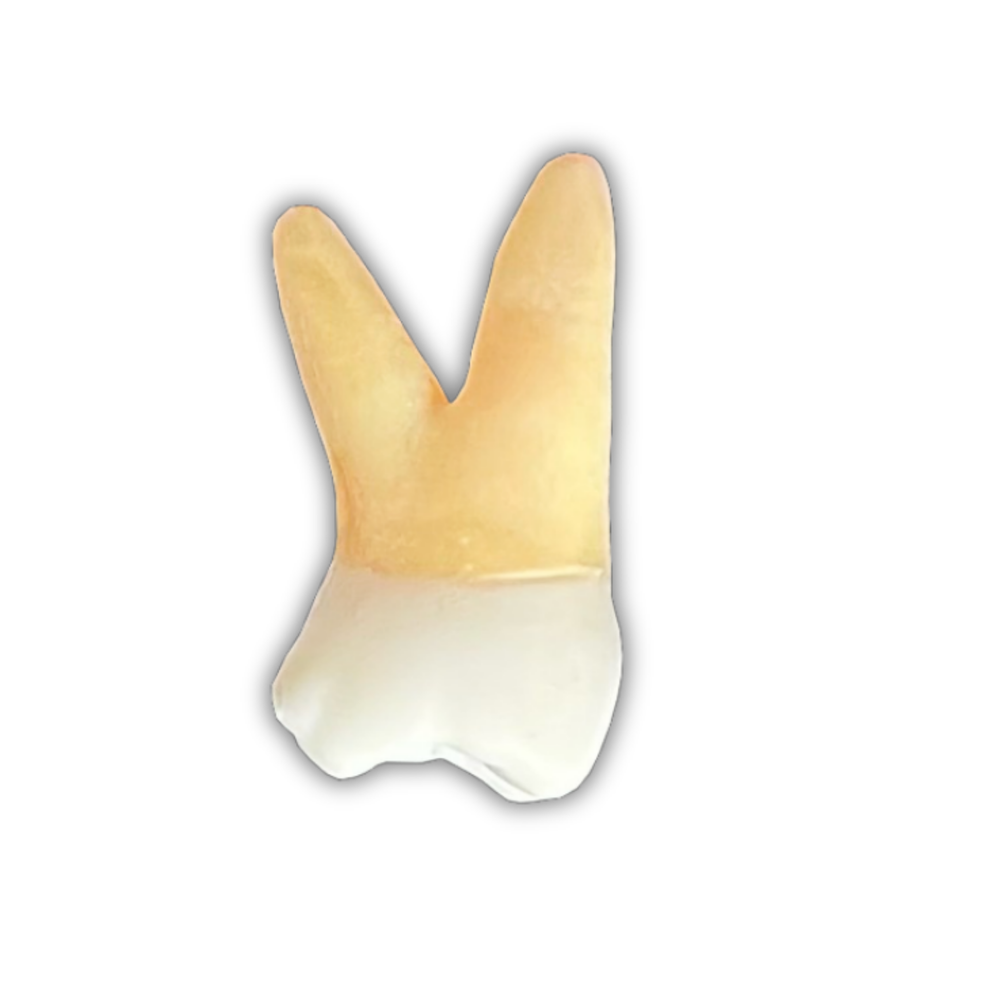 DENTE ENDO 26 RADIOPACO