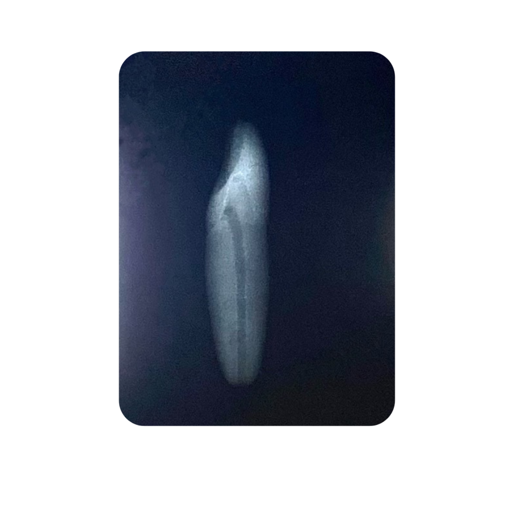 DENTE ENDO 31 RADIOPACO