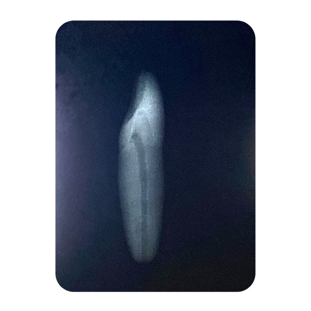 DENTE ENDO 32 RADIOPACO