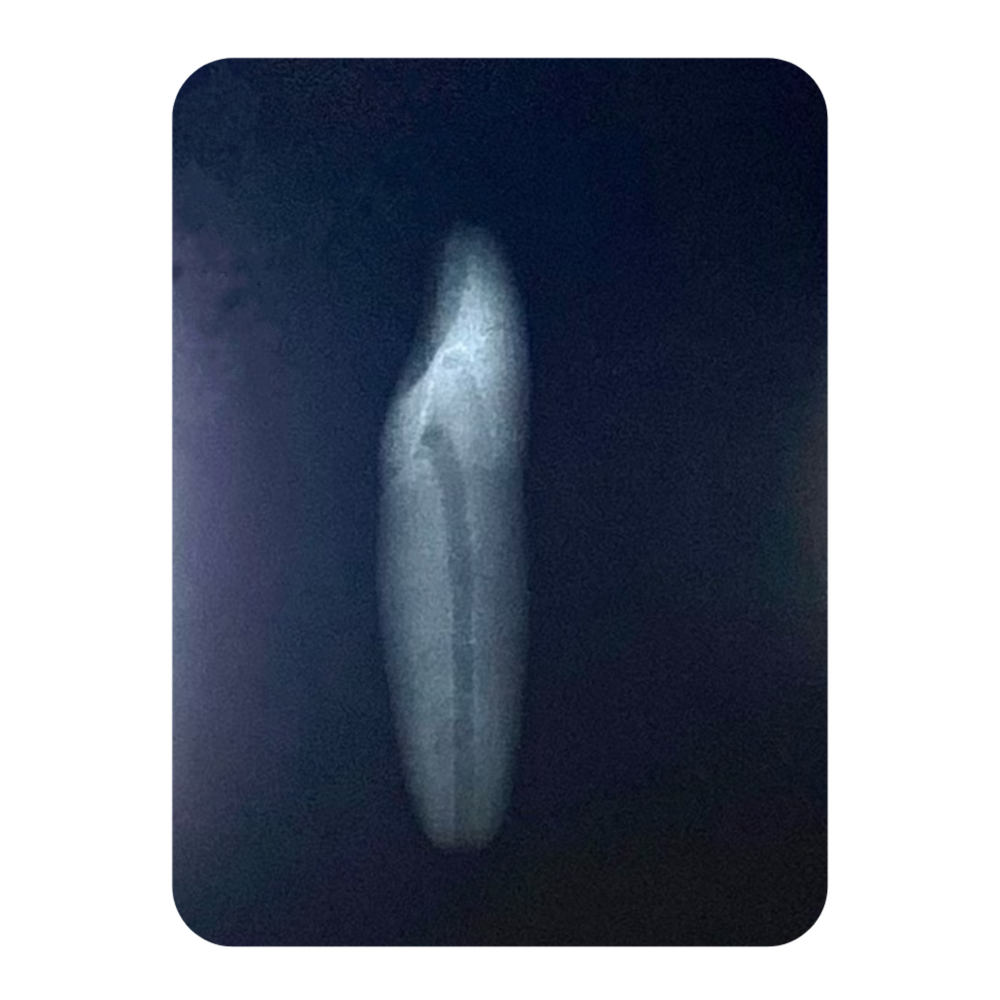 DENTE ENDO 33 RADIOPACO