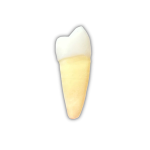 DENTE ENDO 34 RADIOPACO