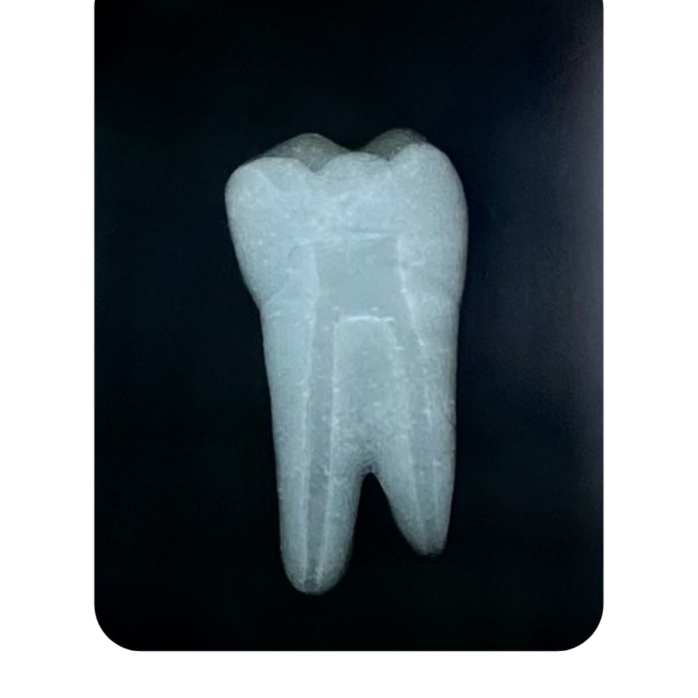 DENTE ENDO 36 RADIOPACO
