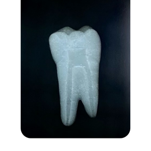 DENTE ENDO 37 RADIOPACO