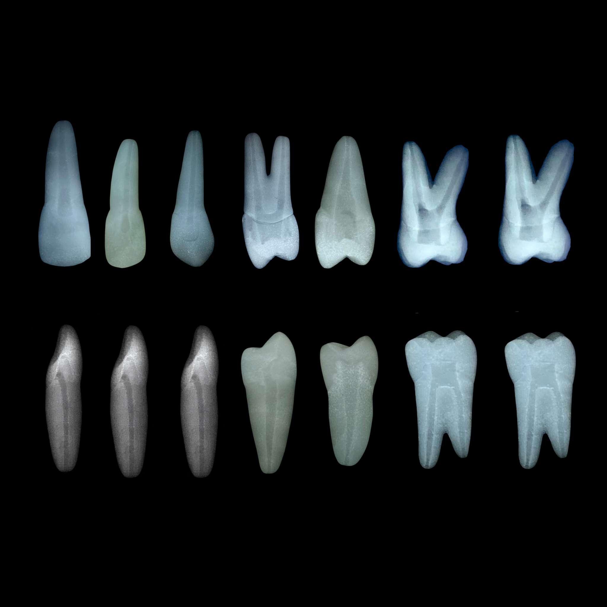 Radiografia periapical de Dentes Orais com lima visível dentro do canal — odontometria por imagem
