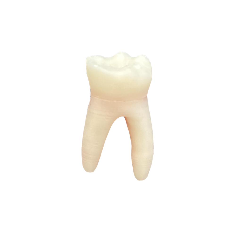 DENTE DECÍDUO 74 POLPADO RADIOPACO (10474)