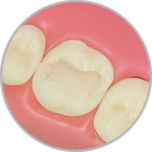 Dente 16 - Classe I (O) (cod:16.A)