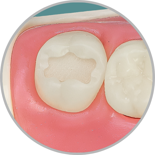 Dente 18 - Classe I (O) (cod:18.A)