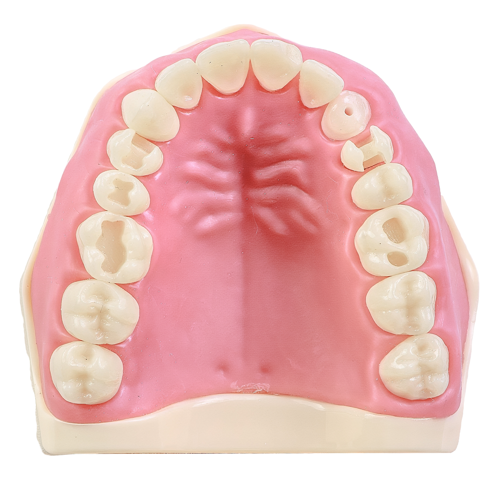 MNQ MATERIAIS DENTARIOS 201 SUPERIOR (201SUP)