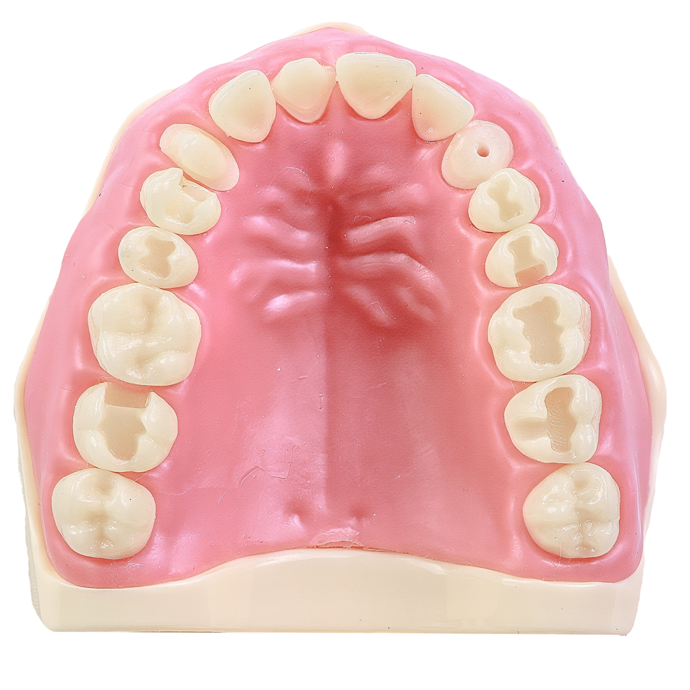 MNQ MATERIAIS DENTARIOS 210 SUPERIOR (210SUP)