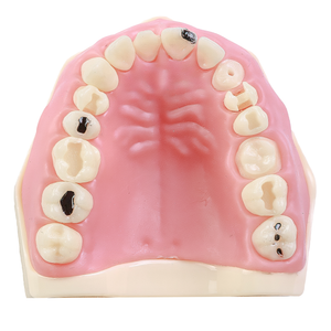 MNQ MATERIAIS DENTARIOS 217 SUPERIOR (217SUP)