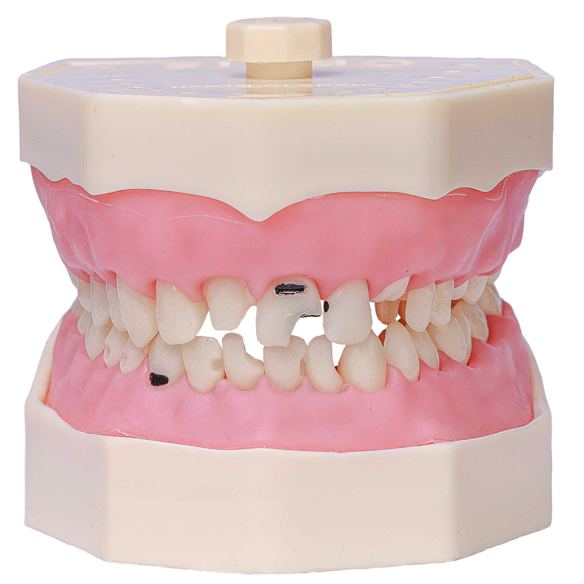Manequim Orais 217 com dentes preparados e cariados