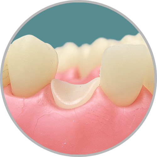 Dente 23 - Coto dental a nível de gengiva (cod:23.C)