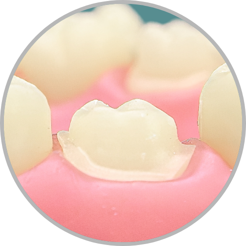 Dente 26 - Coroa Total (cod:26.D)