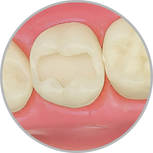 Dente 27 - Classe I (O) (cod:27.A)