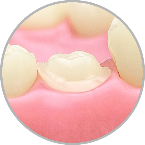 Dente 27 - Coroa Total (cod:27.H)