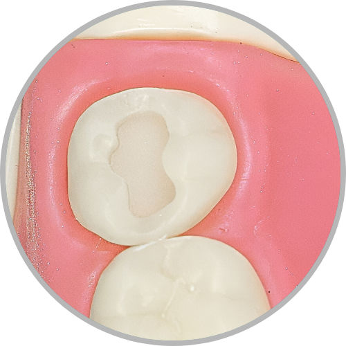 Dente 28 - Classe I (O) (cod:28.A)