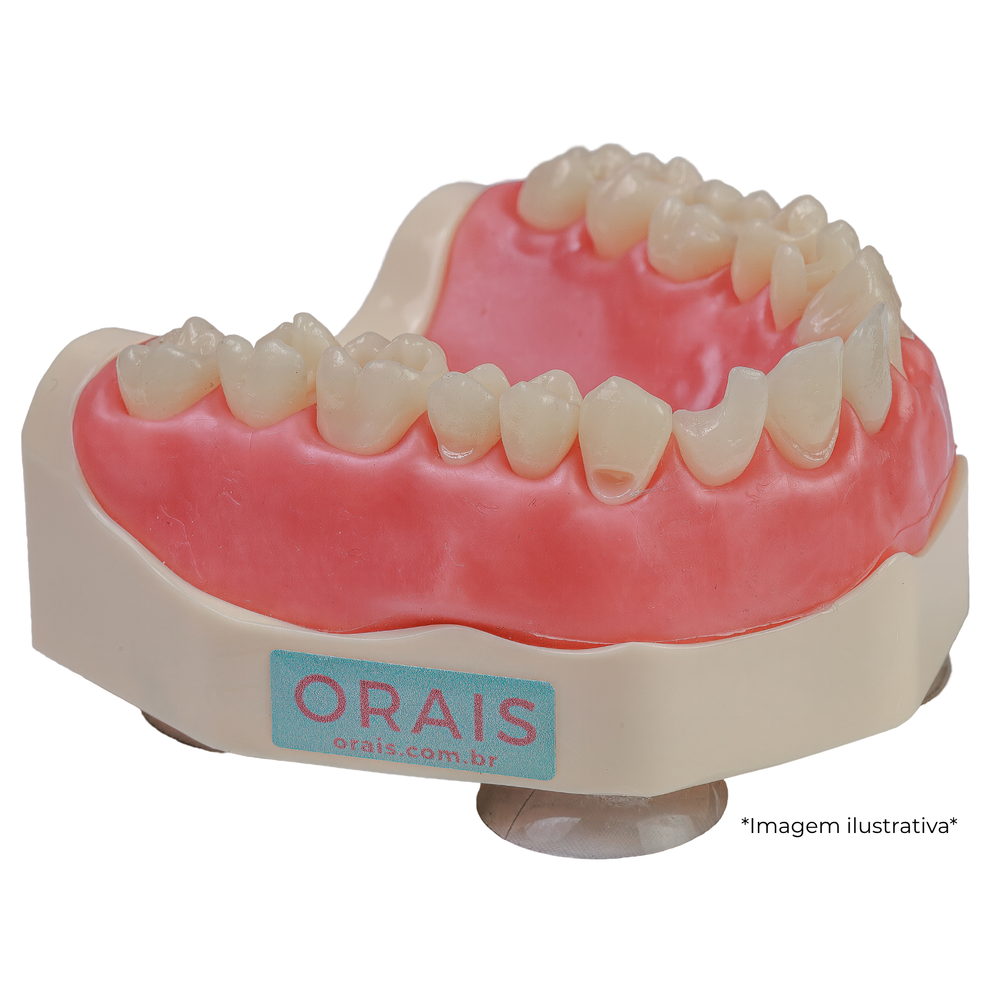 MNQ SUPUPERIOR MTD 287 (287SUP)