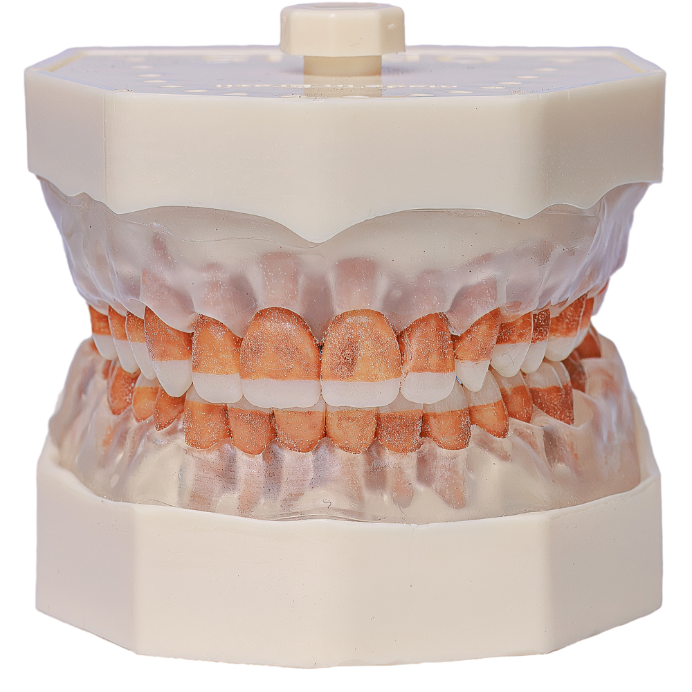 MNQ DE PERIO DENTE ASPERO (300A)