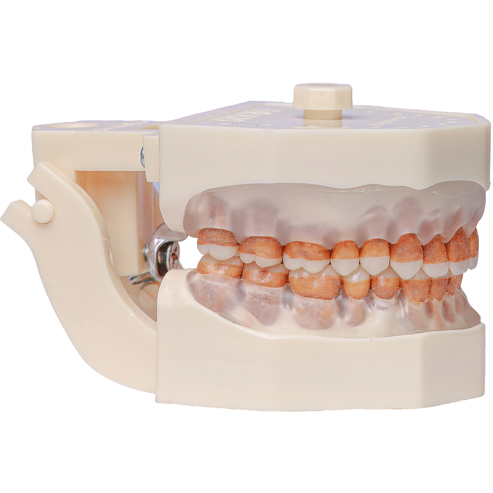 MNQ DE PERIO DENTE ASPERO (300A)