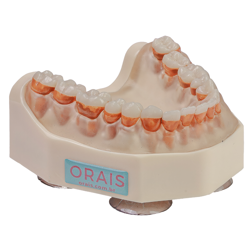 MNQ INFERIOR PERIO  (300INF)