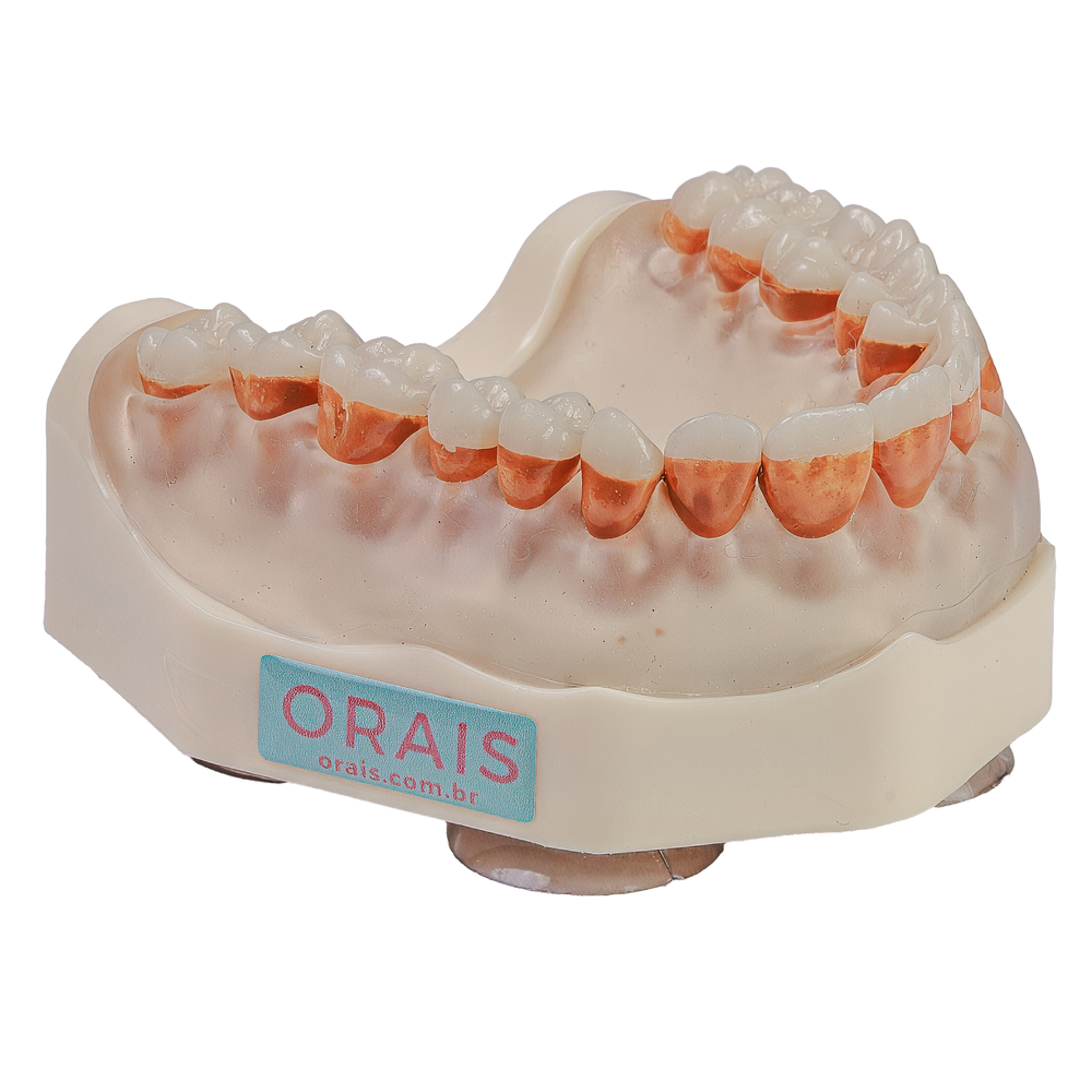 MNQ PERIODONTIA PADRÃO SUPERIOR (300SUP)