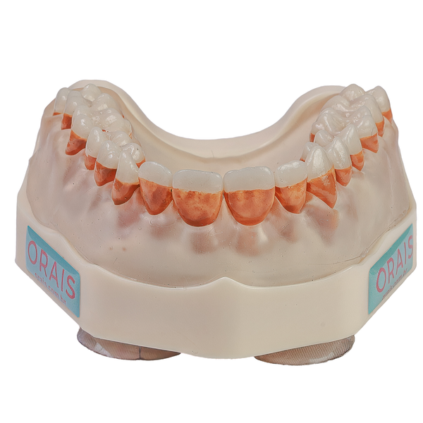 MNQ PERIODONTIA PADRÃO SUPERIOR (300SUP)