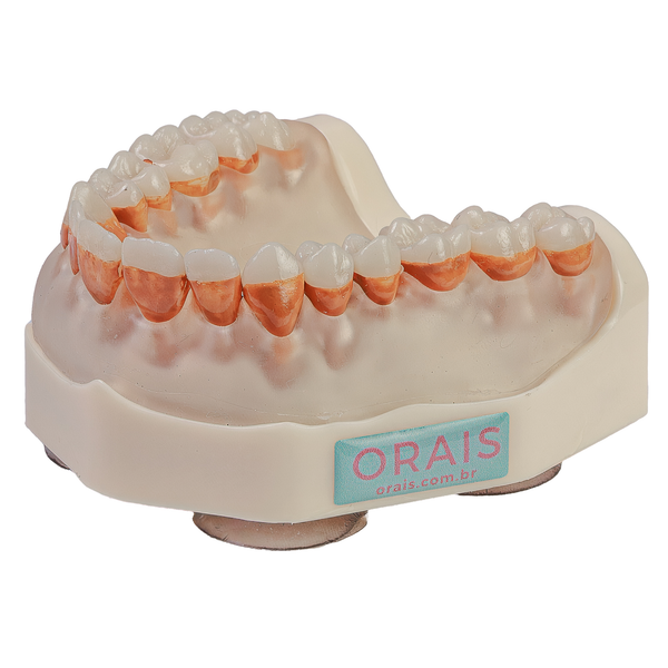 MNQ PERIODONTIA PADRÃO SUPERIOR (300SUP)