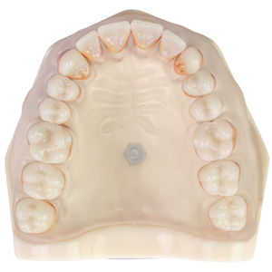 MNQ PERIODONTIA PADRÃO SUPERIOR (300SUP)