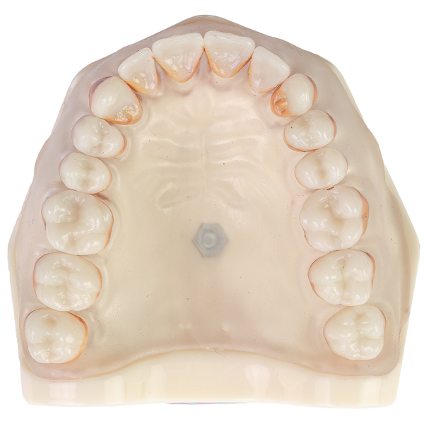 MNQ PERIODONTIA PADRÃO SUPERIOR (300SUP)