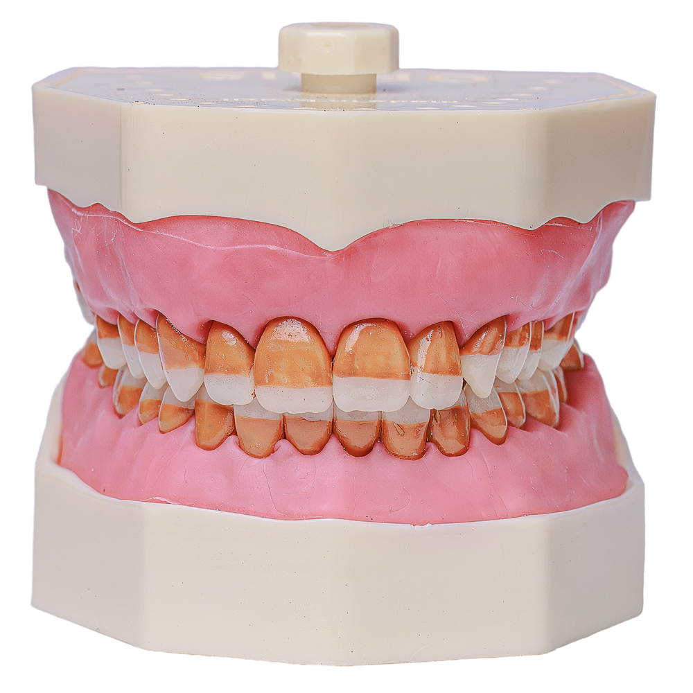 MNQ DE PERIO GENGIVA ROSA  (308)