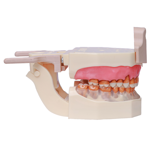 MNQ DE PERIODONTIA FG VERUSKA (3091DA)