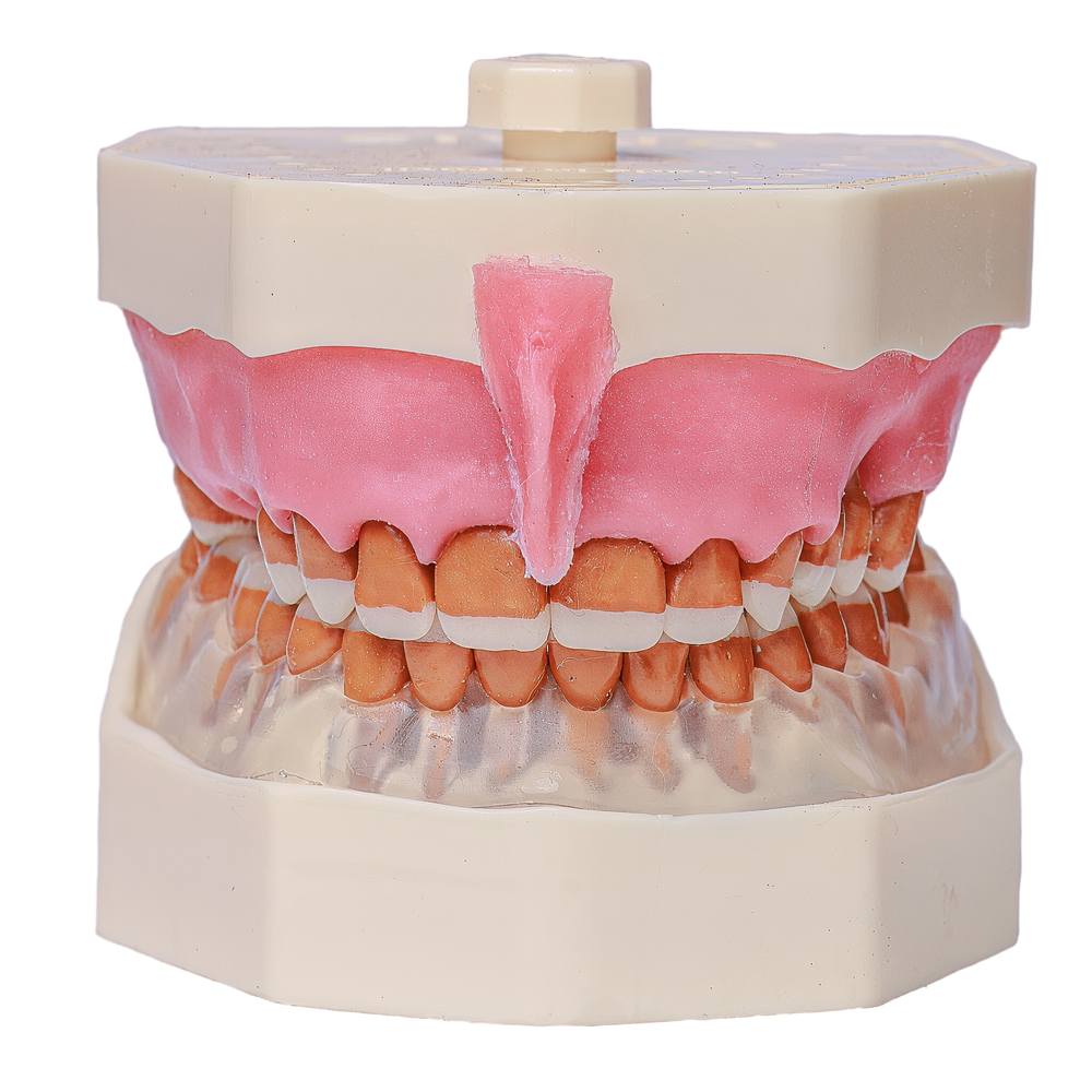 MNQ DE PERIODONTIA FG COM FREIO (3095)