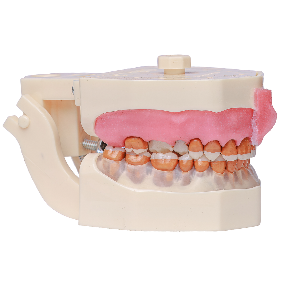 MNQ DE PERIODONTIA FG COM FREIO (3095)