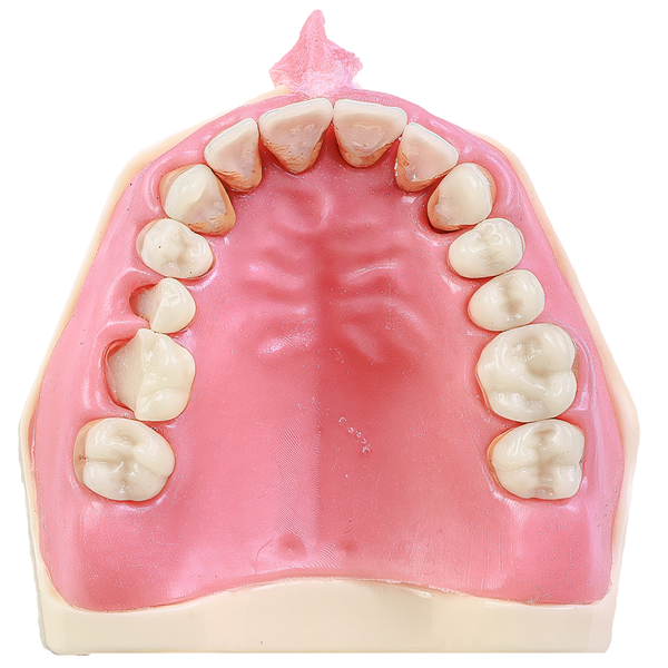 MNQ DE PERIODONTIA FG COM FREIO (3095)