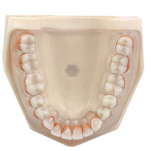 MNQ DE PERIODONTIA FG COM FREIO (3095)