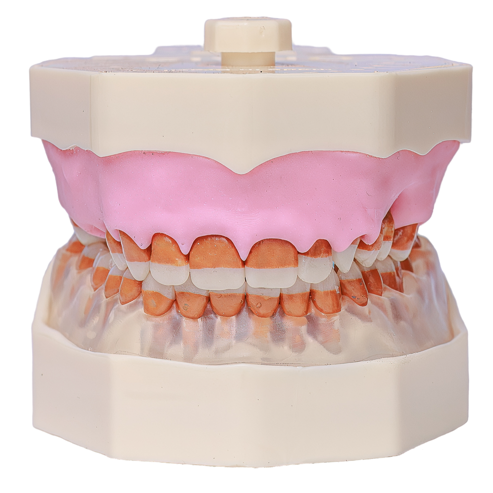 MNQ DE PERIODONTIA FG PALATO (3096)