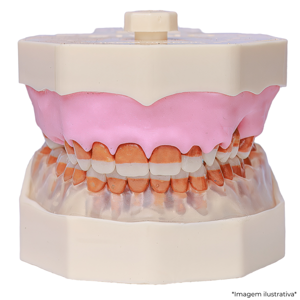 MNQ DE PERIODONTIA FG -UNISAGRADO (3094)